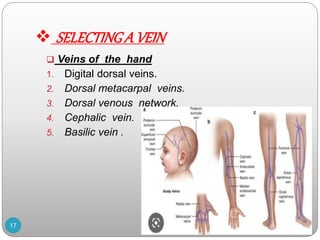  SELECTINGA VEIN
 Veins of the hand
1. Digital dorsal veins.
2. Dorsal metacarpal veins.
3. Dorsal venous network.
4. Cephalic vein.
5. Basilic vein .
17
 