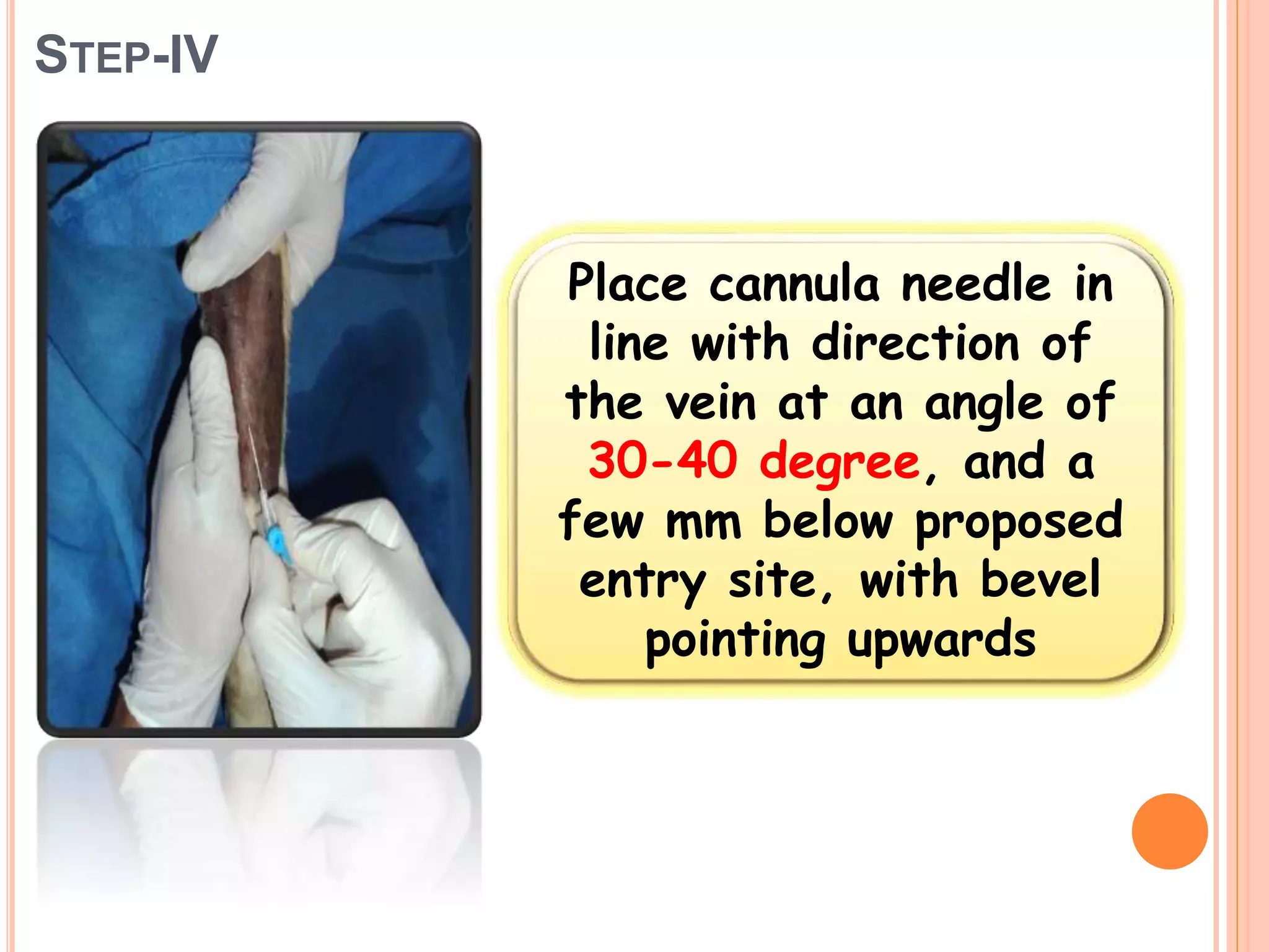 STEP-IV
Place cannula needle in
line with direction of
the vein at an angle of
30-40 degree, and a
few mm below proposed
entry site, with bevel
pointing upwards
 