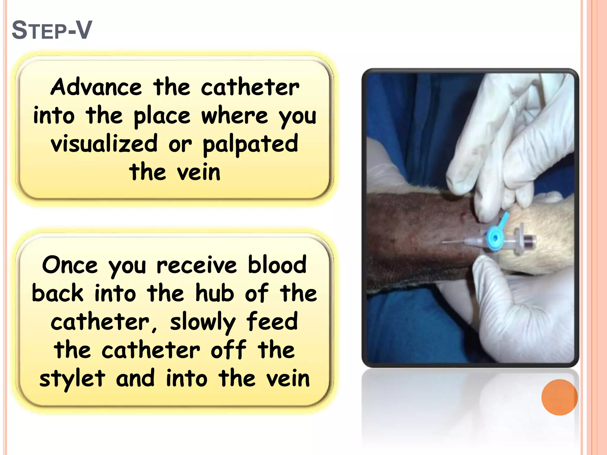 STEP-V
Advance the catheter
into the place where you
visualized or palpated
the vein
Once you receive blood
back into the hub of the
catheter, slowly feed
the catheter off the
stylet and into the vein
 