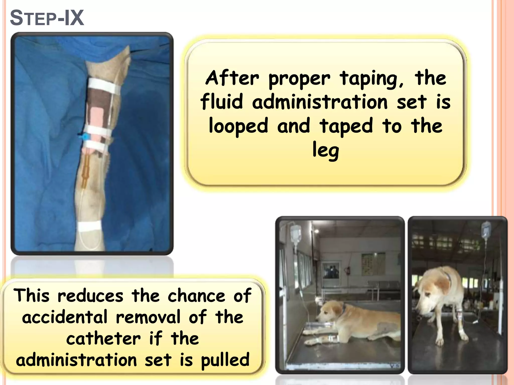 STEP-IX
After proper taping, the
fluid administration set is
looped and taped to the
leg
This reduces the chance of
accidental removal of the
catheter if the
administration set is pulled
 