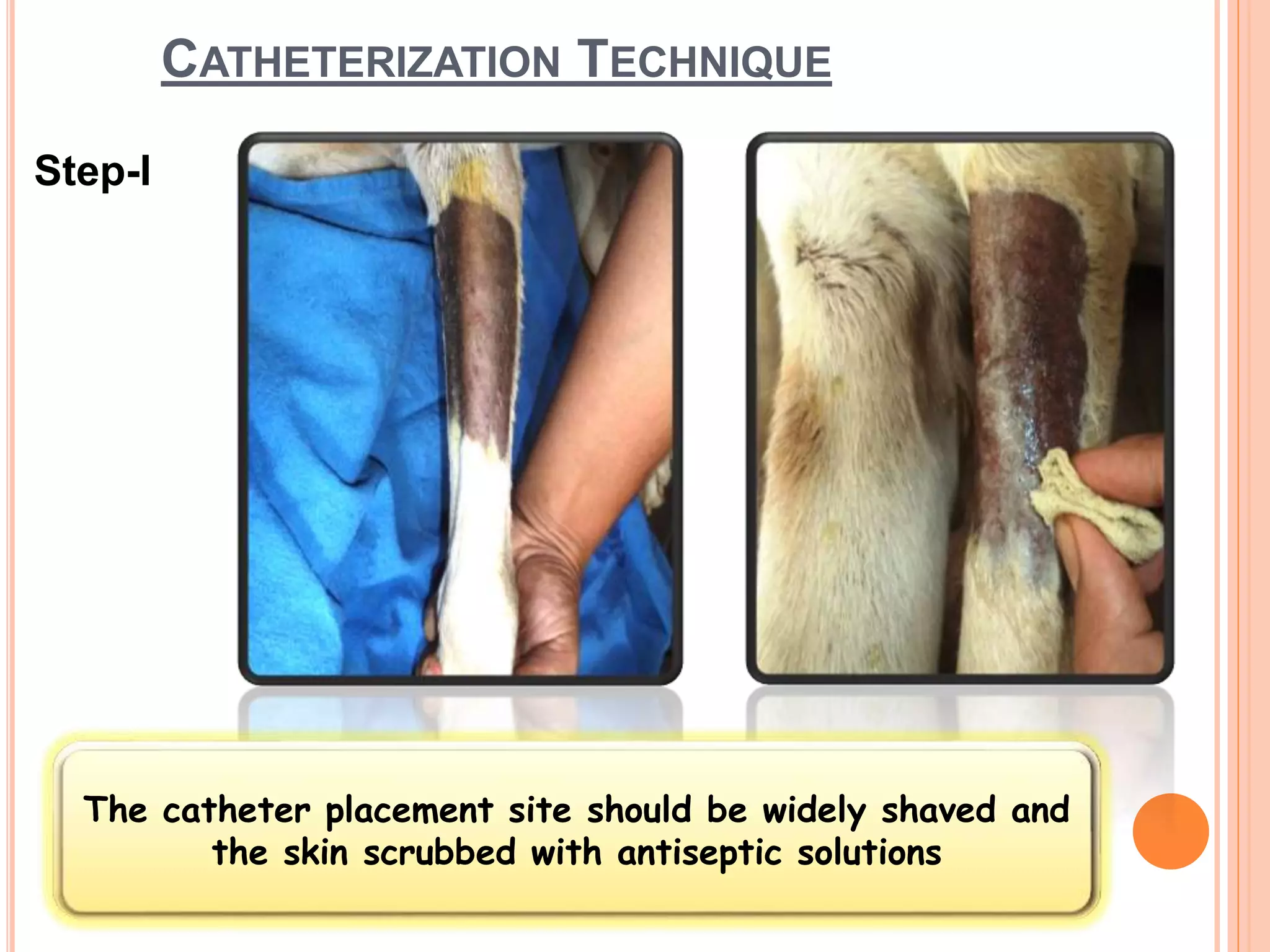 CATHETERIZATION TECHNIQUE
Step-I
The catheter placement site should be widely shaved and
the skin scrubbed with antiseptic solutions
 