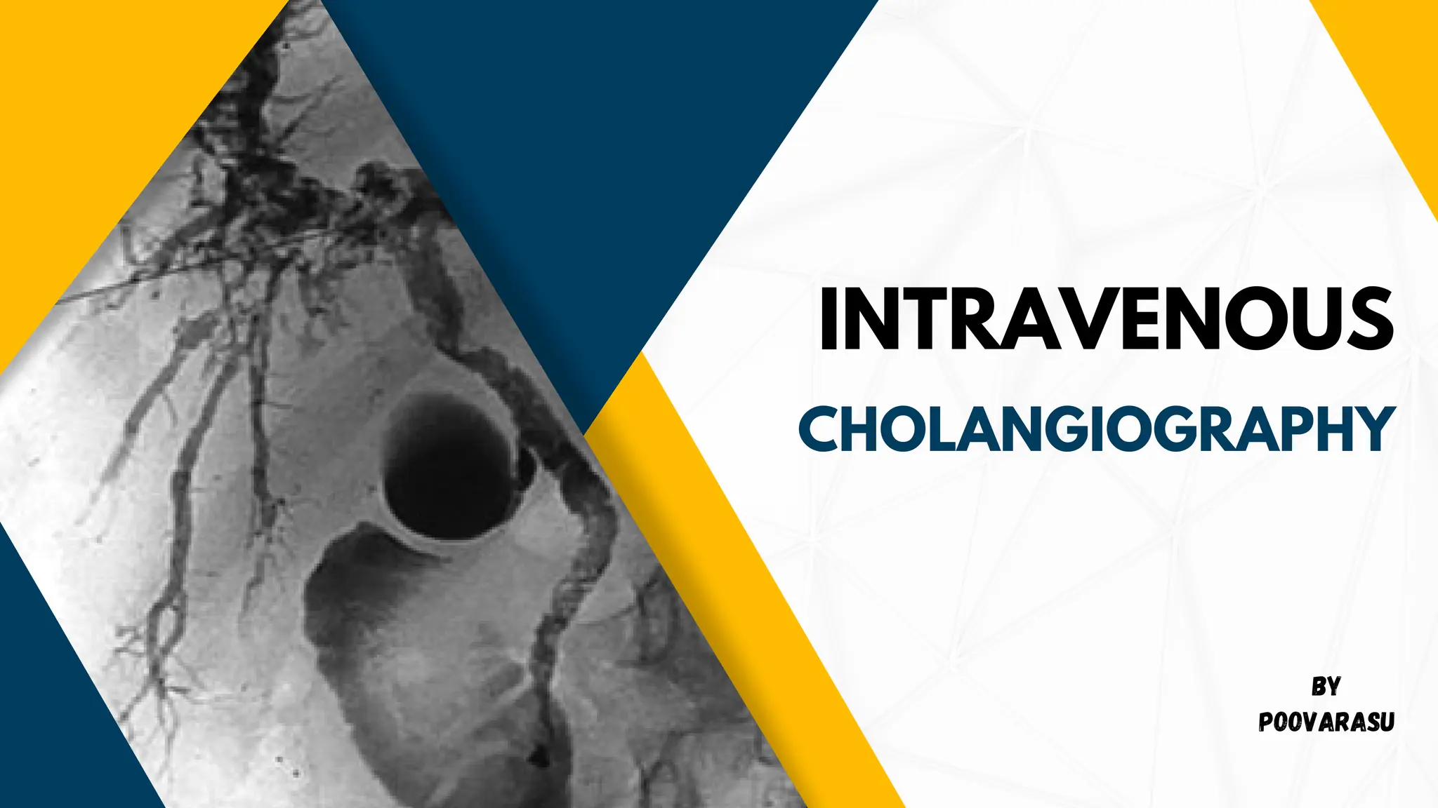 Intravenous Cholangiography procedure done in radiology department | PDF