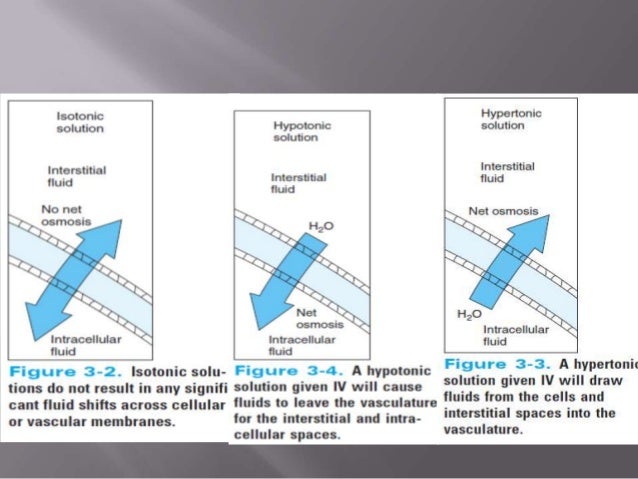 intravenous fluids