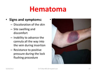 Hematoma
• Signs and symptoms:
– Discoloration of the skin
– Site swelling and
discomfort
– Inability to advance the
cannula all the way into
the vein during insertion
– Resistance to positive
pressure during the lock
flushing procedure
• Document
10/20/2012 Dr.T.V.Rao MD @ Hospital care 17
 