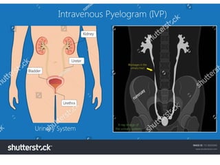 Intravenous Pyelogram RENAL TESTS ADULTS.pptx