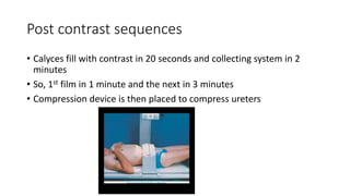 Post contrast sequences
• Calyces fill with contrast in 20 seconds and collecting system in 2
minutes
• So, 1st film in 1 minute and the next in 3 minutes
• Compression device is then placed to compress ureters
 