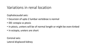 Variations in renal location
Cephalocaudal axis:
• Excursion of upto 2 lumbar vertebrae is normal
• DD: ectopia vs ptosis
• In ptosis, ureters will be of normal length or might be even kinked
• In ectopia, ureters are short
Coronal axis:
Lateral displaced kidney
 