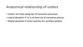 Anatomical relationship of ureters
• Ureters are lined along tips of transverse processes
• Lateral deviation if >1.5 cm from tip of transverse process
• Medial deviation if ureter overlies the vertebral pedicle
 