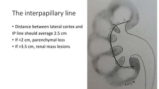 The interpapillary line
• Distance between lateral cortex and
IP line should average 2.5 cm
• If <2 cm, parenchymal loss
• If >3.5 cm, renal mass lesions
 