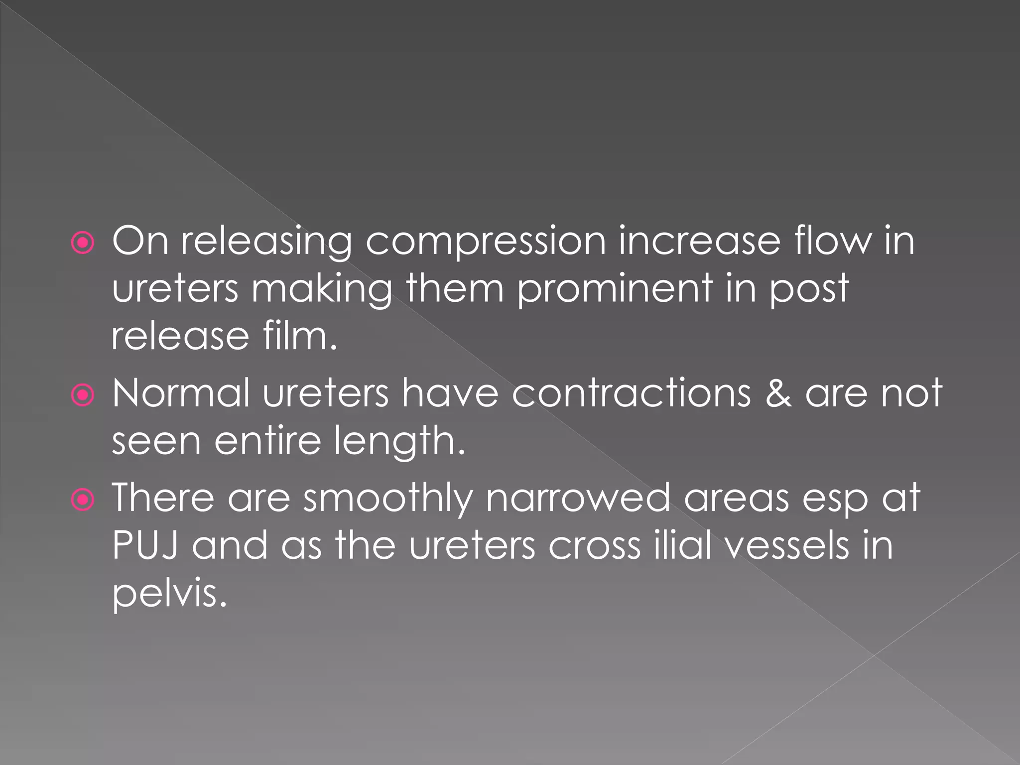  On releasing compression increase flow in
ureters making them prominent in post
release film.
 Normal ureters have contractions & are not
seen entire length.
 There are smoothly narrowed areas esp at
PUJ and as the ureters cross ilial vessels in
pelvis.
 