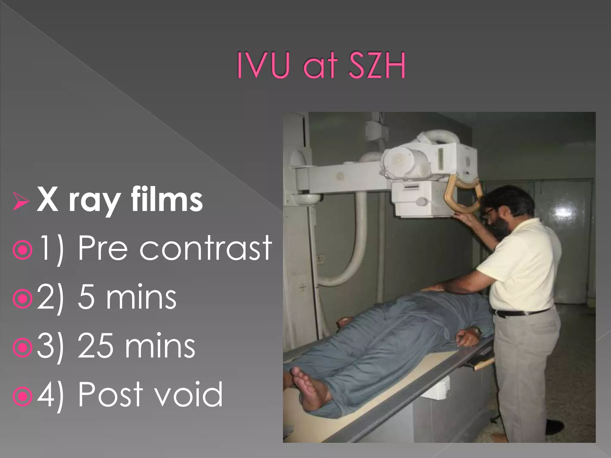 X ray films
1) Pre contrast
2) 5 mins
3) 25 mins
4) Post void
 