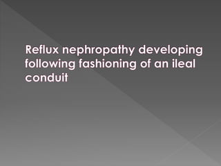 Intravenous urography