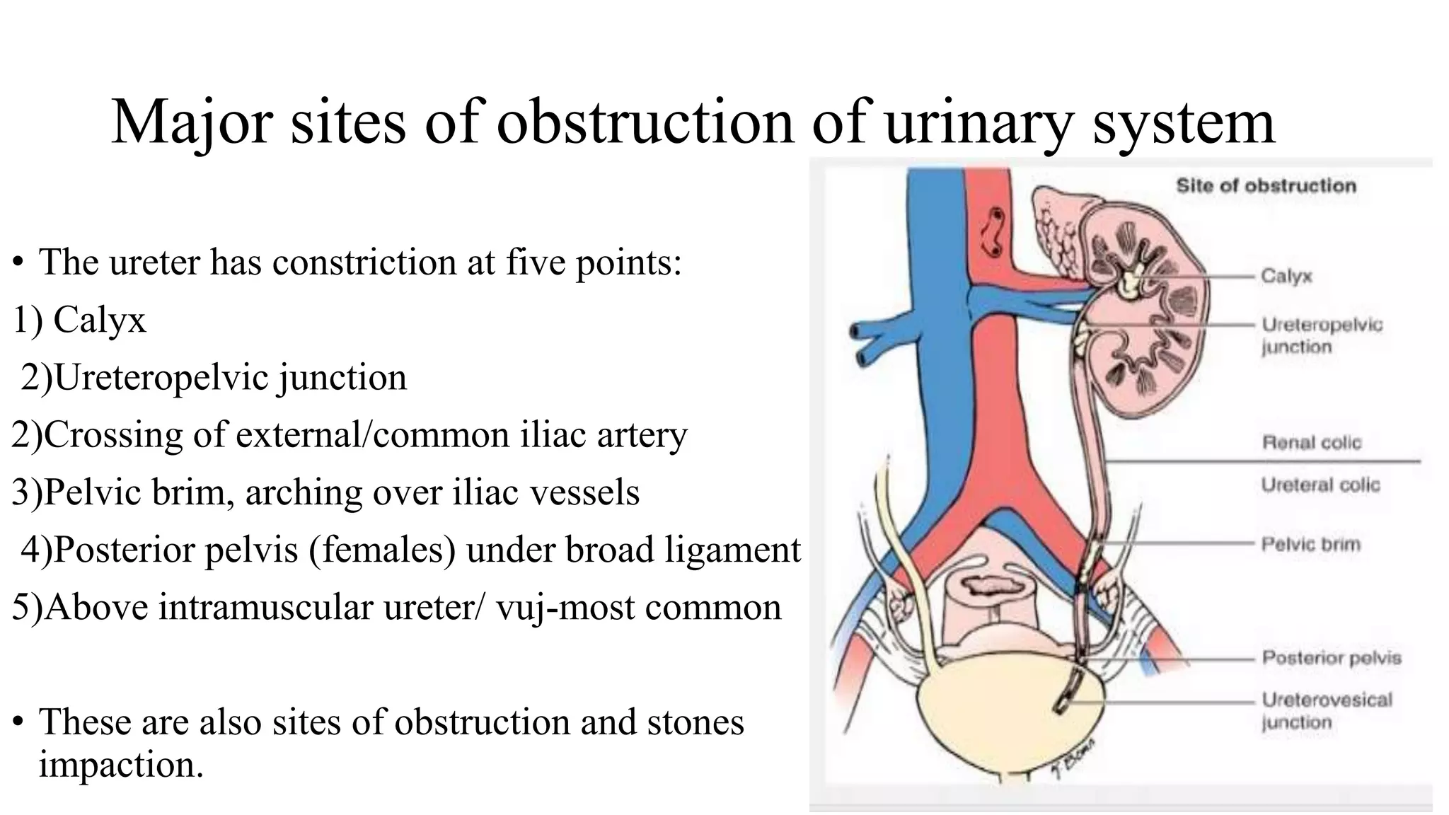 Intravenous urography and its modifications.pptx 01 | PPTX