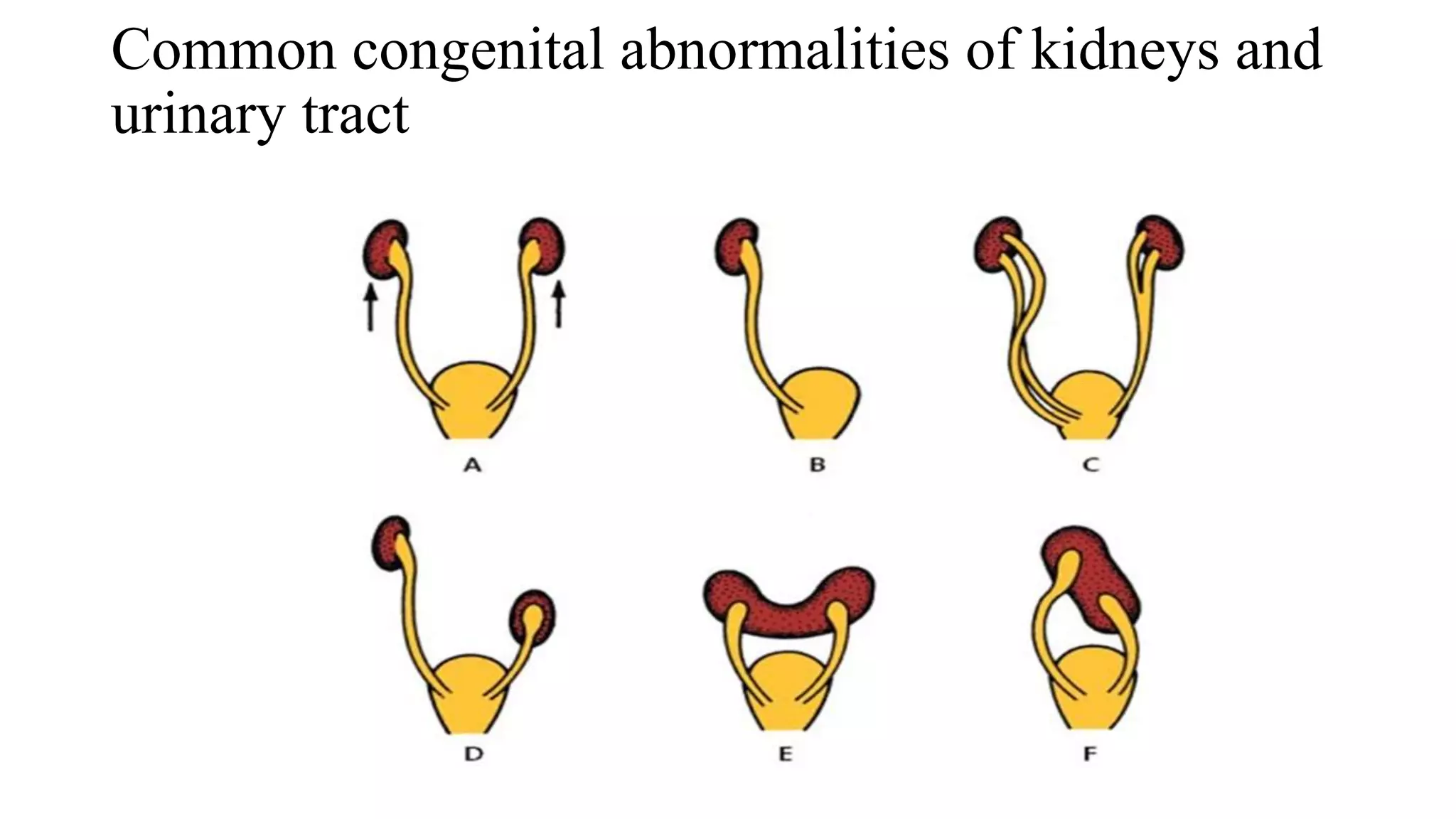 Intravenous urography and its modifications.pptx 01 | PPTX