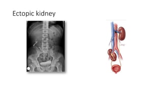 Intravenous urography and its modifications.pptx 01 | PPT