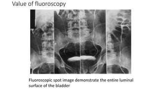 Intravenous urography and its modifications.pptx 01 | PPT