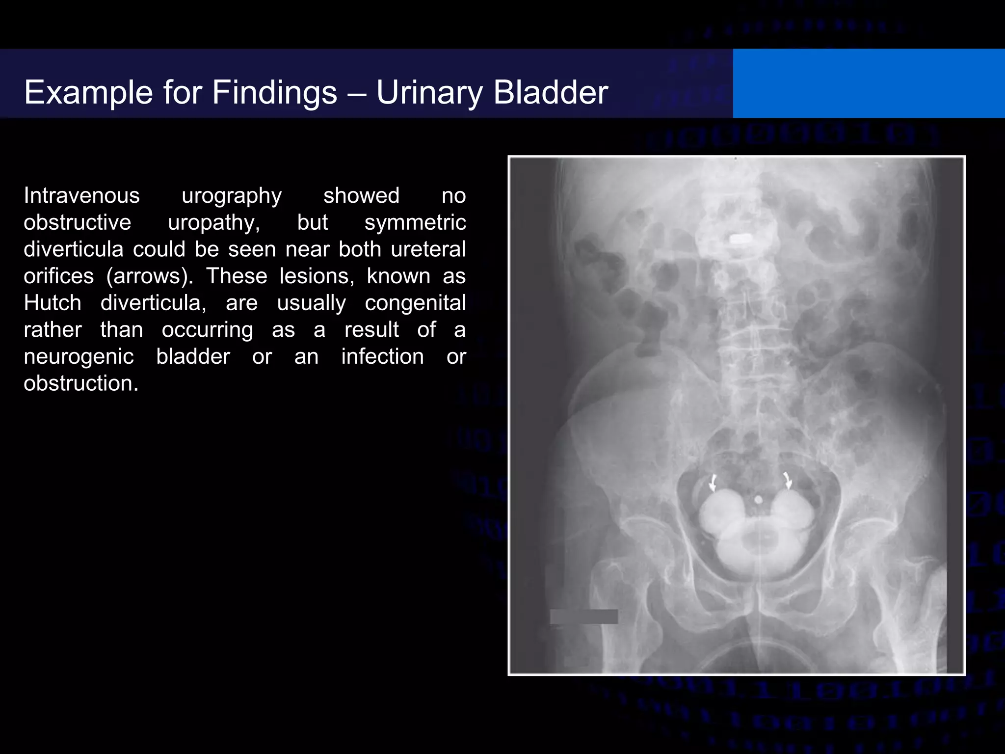Intravenous urography (IVU) | PDF | Digestive Disorders | Diseases and ...