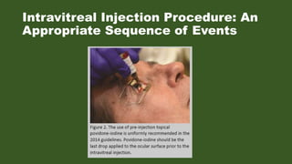 Intravitreal injection | PPTX