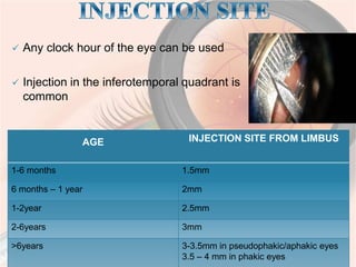 Intravitreal injection | PPTX