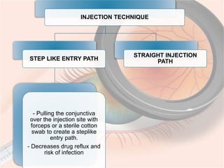 Intravit Injection Procedure Intravitreal injection | PPTX