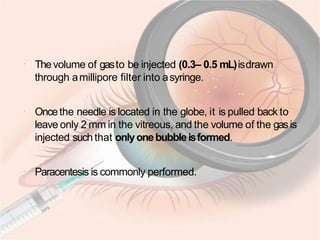 Intravit Injection Procedure Intravitreal injection | PPTX