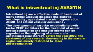 Intravitreal injection avastin facts and myths | PPTX