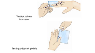 Testing Interossei Strength intrinsic muscles of Hand.pptx