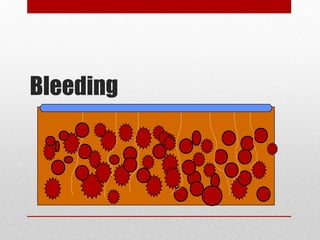 Bleeding
 