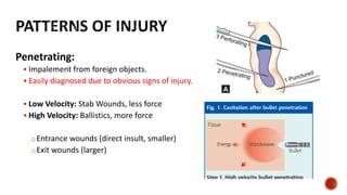Penetrating:
 Impalement from foreign objects.
 Easily diagnosed due to obvious signs of injury.
 Low Velocity: Stab Wounds, less force
 High Velocity: Ballistics, more force
oEntrance wounds (direct insult, smaller)
oExit wounds (larger)
 
