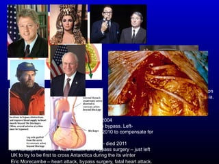 Bill Clinton – quadruple bypass surgery in 2004
Dick Cheney – (VP to GW Bush) quadruple bypass. Left-
ventricular assist device (LVAD) fitted July 2010 to compensate for
increasing congestive heart failure.
Elizabeth Taylor – congestive heart failure – died 2011
Sir Ranulph Fiennes – heart attack and bypass surgery – just left
UK to try to be first to cross Antarctica during the its winter
Eric Morecambe – heart attack, bypass surgery, fatal heart attack.
John Candy died aged 43 from advanced
atherosclerosis, which caused a coronary
embolism, leading to a myocardial infarction
(heart attack) and a fatal cardiac arrhythmia.
His father died aged 35.
 