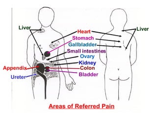 Areas of Referred Pain Liver Appendix Ureter Liver Heart Stomach Gallbladder Small intestines Ovary Kidney Colon Bladder 