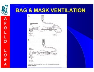 BAG  MMAASSKK VVEENNTTIILLAATTIIOONN 
A 
P 
O 
L 
L 
O 
L 
O 
G 
A 
 