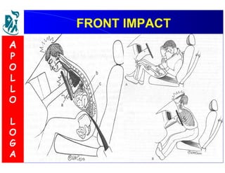 FFRROONNTT IIMMPPAACCTT 
A 
P 
O 
L 
L 
O 
L 
O 
G 
A 
 