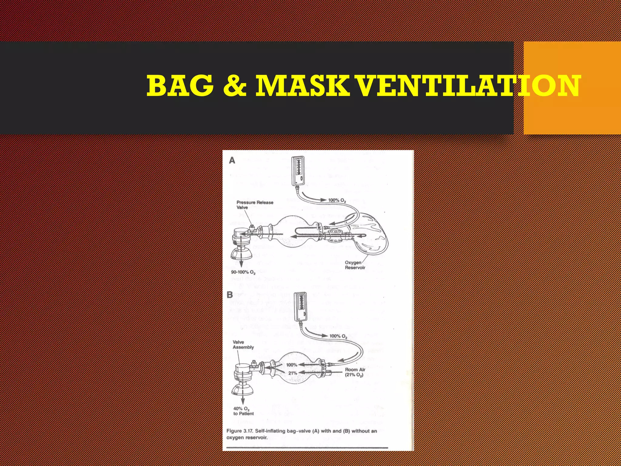 BAG & MASKVENTILATION
 