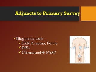 Adjuncts to Primary Survey
• Diagnostic tools
CXR, C-spine, Pelvis
DPL
Ultrasound FAST
 