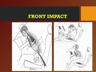 FRONT IMPACT
 
