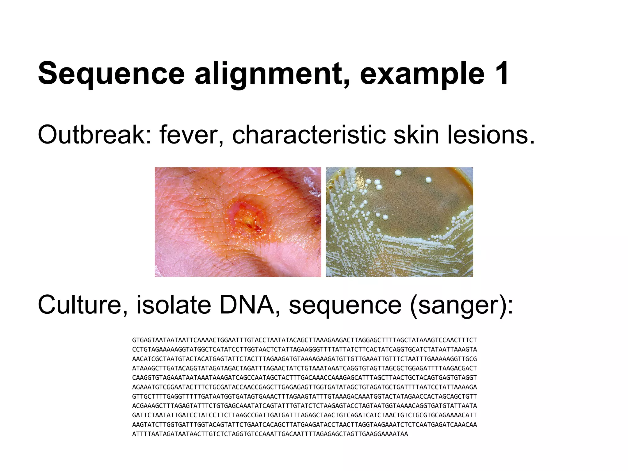 Sequence alignment, example 1
Outbreak: fever, characteristic skin lesions.




Culture, isolate DNA, sequence (sanger):
        GTGAGTAATAATAATTCAAAACTGGAATTTGTACCTAATATACAGCTTAAAGAAGACTTAGGAGCTTTTAGCTATAAAGTCCAACTTTCT
        CCTGTAGAAAAAGGTATGGCTCATATCCTTGGTAACTCTATTAGAAGGGTTTTATTATCTTCACTATCAGGTGCATCTATAATTAAAGTA
        AACATCGCTAATGTACTACATGAGTATTCTACTTTAGAAGATGTAAAAGAAGATGTTGTTGAAATTGTTTCTAATTTGAAAAAGGTTGCG
        ATAAAGCTTGATACAGGTATAGATAGACTAGATTTAGAACTATCTGTAAATAAATCAGGTGTAGTTAGCGCTGGAGATTTTAAGACGACT
        CAAGGTGTAGAAATAATAAATAAAGATCAGCCAATAGCTACTTTGACAAACCAAAGAGCATTTAGCTTAACTGCTACAGTGAGTGTAGGT
        AGAAATGTCGGAATACTTTCTGCGATACCAACCGAGCTTGAGAGAGTTGGTGATATAGCTGTAGATGCTGATTTTAATCCTATTAAAAGA
        GTTGCTTTTGAGGTTTTTGATAATGGTGATAGTGAAACTTTAGAAGTATTTGTAAAGACAAATGGTACTATAGAACCACTAGCAGCTGTT
        ACGAAAGCTTTAGAGTATTTCTGTGAGCAAATATCAGTATTTGTATCTCTAAGAGTACCTAGTAATGGTAAAACAGGTGATGTATTAATA
        GATTCTAATATTGATCCTATCCTTCTTAAGCCGATTGATGATTTAGAGCTAACTGTCAGATCATCTAACTGTCTGCGTGCAGAAAACATT
        AAGTATCTTGGTGATTTGGTACAGTATTCTGAATCACAGCTTATGAAGATACCTAACTTAGGTAAGAAATCTCTCAATGAGATCAAACAA
        ATTTTAATAGATAATAACTTGTCTCTAGGTGTCCAAATTGACAATTTTAGAGAGCTAGTTGAAGGAAAATAA
 