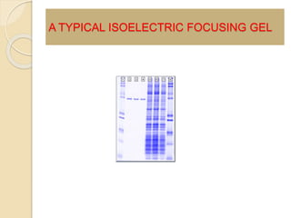 A TYPICAL ISOELECTRIC FOCUSING GEL
 