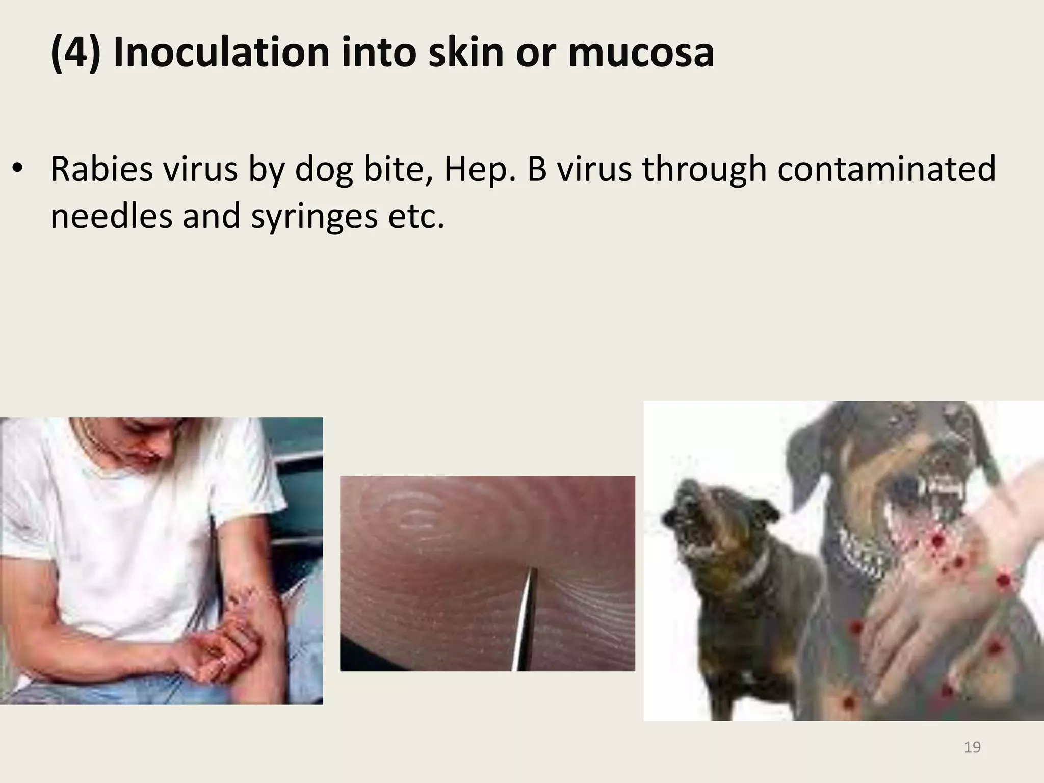 (4) Inoculation into skin or mucosa
• Rabies virus by dog bite, Hep. B virus through contaminated
needles and syringes etc.
19
 