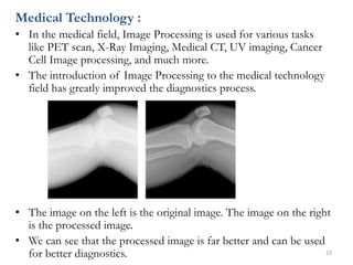 Medical Technology :
• In the medical field, Image Processing is used for various tasks
like PET scan, X-Ray Imaging, Medi...