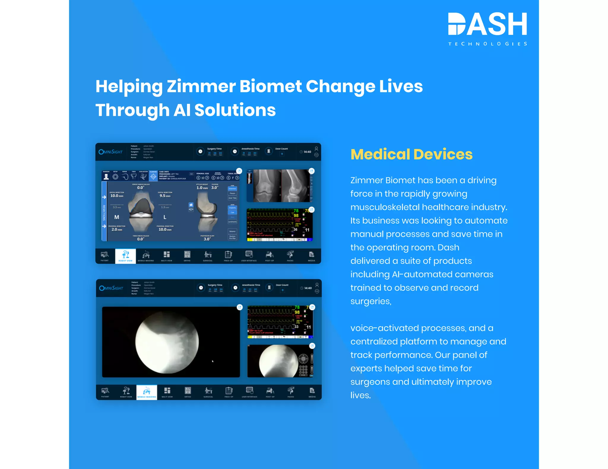 Helping Zimmer Biomet Change Lives
Through AI Solutions
Medical Devices
Zimmer Biomet has been a driving
force in the rapidly growing
musculoskeletal healthcare industry.
Its business was looking to automate
manual processes and save time in
the operating room. Dash
delivered a suite of products
including AI-automated cameras
trained to observe and record
surgeries,
voice-activated processes, and a
centralized platform to manage and
track performance. Our panel of
experts helped save time for
surgeons and ultimately improve
lives.
 