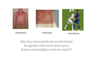 Queimaduras

Cicatrização

Traumatismos

Não há a necessidade do envolvimento
de agentes infecciosos para que o
Sistema Imunológico entre em ação!!!

 