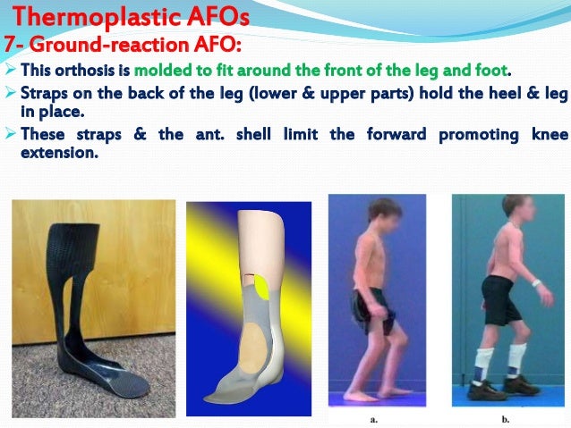 Introd Amp Ll Orthosis Dr Aliaa