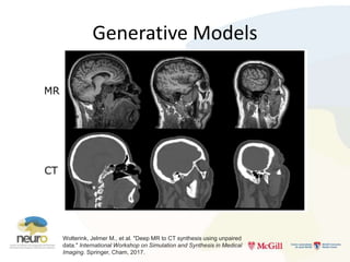 Introduction to Deep Learning for Neuroimaging | PPTX