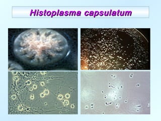 Histoplasma capsulatumHistoplasma capsulatum
 
