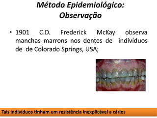 Método Epidemiológico:
Observação
• 1901 C.D. Frederick McKay
manchas marrons nos dentes de
de de Colorado Springs, USA;
observa
indivíduos
Tais indivíduos tinham um resistência inexplicável a cáries
 