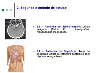  2.3 – Anatomia por Rádio-imagem: Utiliza
imagens (Raios X) , tomografias,
ressonâncias magnéticas.
 2.4 – Anatomia de Superfície: Trata da
descrição visual da estrutura anatômica sem
dissecar o organismo.
2. Segundo o método de estudo:
 