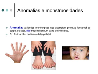 Anomalias e monstruosidades
 Anomalia: variações morfológicas que acarretam prejuízo funcional ao
corpo, ou seja, não trazem nenhum dano ao indivíduo.
 Ex: Polidactilia ou fissura labiopalatal
 