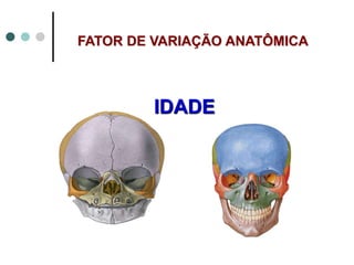 IDADE
FATOR DE VARIAÇÃO ANATÔMICA
 