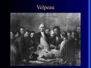 Velpeau
 